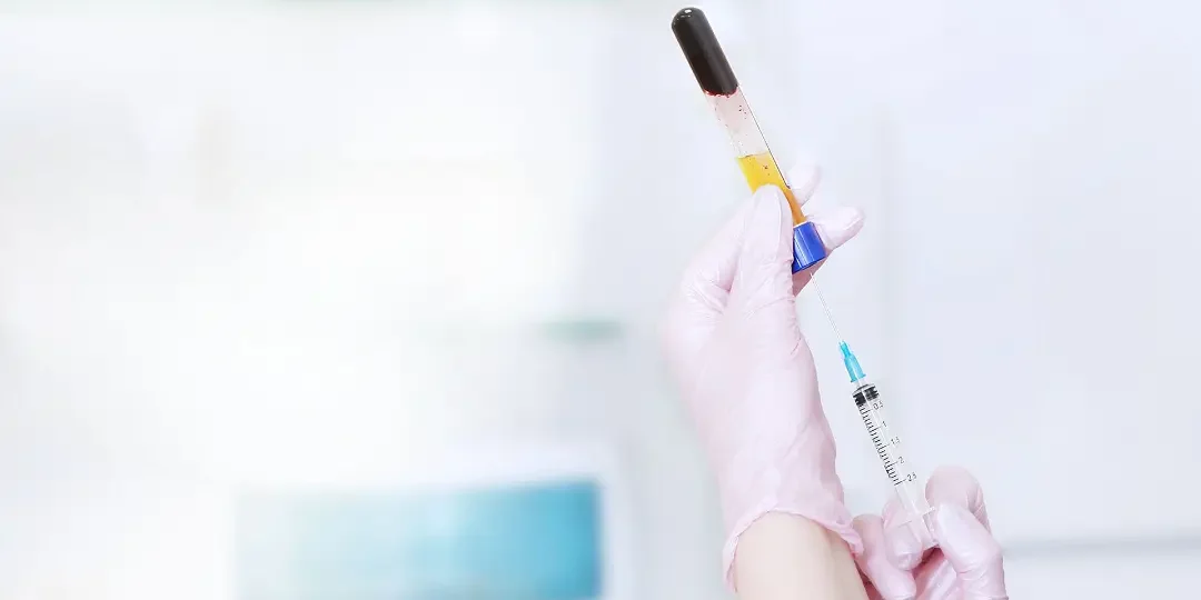 Revolutionizing Musculoskeletal