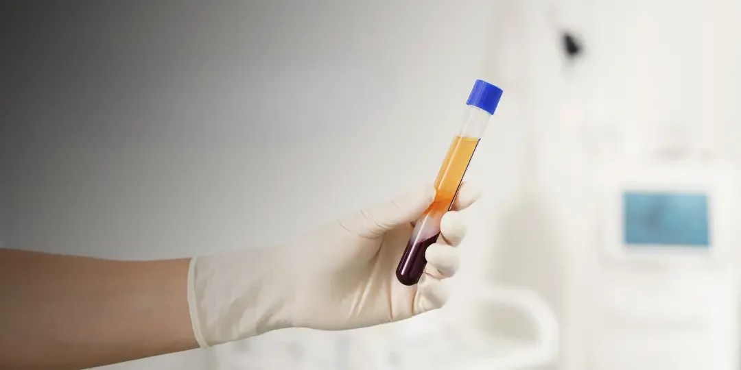prp-plasma