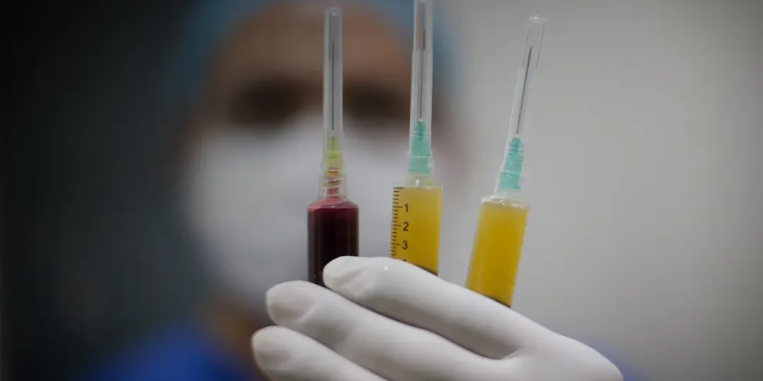 stem-cell vs-prp